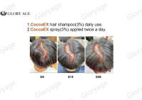 OEM ODM Liquide pour la repousse des cheveux, anti-chute, activateur de croissance des cils, extrait naturel à base de plantes, volumateur, qualité cosmétique, unisexe, cheveux fins