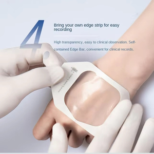 Transparent Breathable Material <strong>Disposable</strong> Film Chg <strong>I.v</strong>. Dressing Wound Fixation <strong>Cannula</strong> Clear Fixed Dressing With Notch - Product Image 3