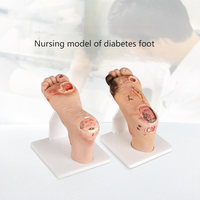 Modelo de pie diabético (leve/grave) para entrenamiento médico y educación