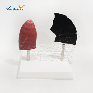 Modèle comparative des poumons normaux et des poumons de fumeurs, utilisé pour la démonstration, l'enseignement et la vulgarisation des lésions pulmonaires. - Product Image 5