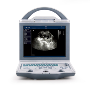 Ecógrafo Veterinario Digital KAIXIN KX5600V con Sonda Convexa Lineal para Perros, Gatos y Animales Pequeños - Product Image 1