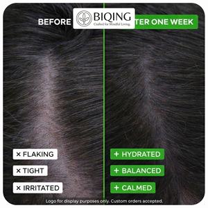 Shampoing Solide Végétalien et Sans Plastique à l'Huile d'Eucalyptus Naturelle pour Cuirs Chevelus Secs, Irrités et Desquamés - Vente en Gros - Product Image 3