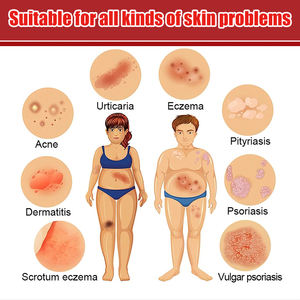 يوننان فطر ملك مئات الأعشاب كريم لتخفيف الحكة العناية بالجسم لتخفيف حكة الجلد - Product Image 3