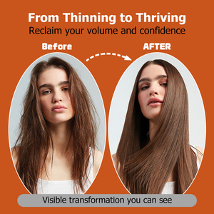 Gummies avancées pour la croissance des cheveux avec vitamine A et biotine – Complément alimentaire favorisant des cheveux plus épais et plus volumineux – Gummies pour la croissance capillaire - Product Image 5