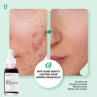 Solution Peeling Visage Éclaircissante Enjoy Skin OBM à l'Acide Hyaluronique et BHA avec Sérum Niacinamide 50ml