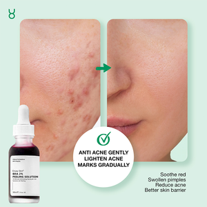 Thưởng thức da OBM làm trắng da mặt chăm sóc hyaluronic axit BHA lột giả<span class=keywords><strong>i</strong></span> pháp vớ<span class=keywords><strong>i</strong></span> Niacinamide huyết thanh 50ml - Product Image 3