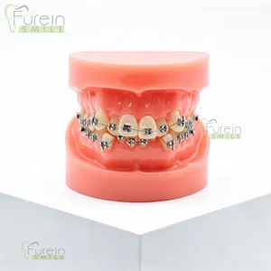 Modèle orthodontique d'inalignement dentaire, modèle de démonstration de malalignement dentaire avec supports pour la formation et l'éducation des dentistes - Product Image 1