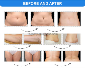 <span class=keywords><strong>Appareil</strong></span> professionnel de <span class=keywords><strong>cryolipolyse</strong></span> 360° pour la réduction complète de la graisse corporelle, destiné aux salons - Product Image 6