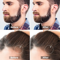 Système de Dermaroller Personnalisé avec Logo 0,5 mm 1 mm 1,5 mm Titane Noir Mat pour la Repousse des Cheveux et de la Barbe, et le Blanchiment
