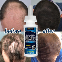 Produits de traitement de repousse des cheveux avec rouleau derma