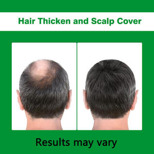 Capsules Premium pour la Croissance des Cheveux avec Palmier Nain, Ashwagandha, Biotine, Collagène Marin, 21 Vitamines et Minéraux pour l'Épaisseur des Cheveux - Product Image 4