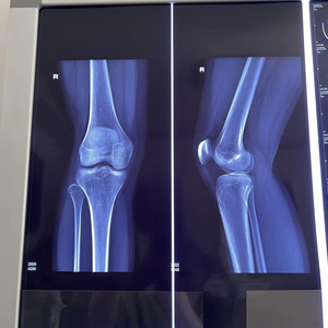 ฟิล์ม PET โปร่งแสงกันน้ำมีความแม่นยำสูงสีสว่าง oki/ <span class=keywords><strong>ฟูจิ</strong></span>/เครื่องพิมพ์ Xerox ct/cr/dr - Product Image 2