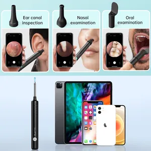 חדש טיפול רפואי אוזן גרון בדיקה וידאו otoscopio וויפי אוטוסקופ אלחוטי מצלמה אנדוסקופ