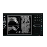 Fuente de Rayos X Portátil de Alta Frecuencia de 8kW, Máquina de Radiografía Digital de 125kV para Uso Médico Veterinario
