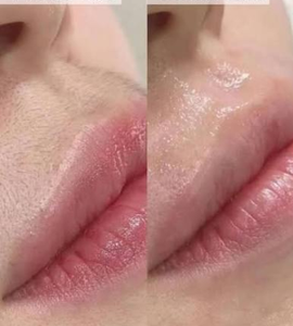 Máquina Profesional de Depilación Láser de Diodo 755nm 808nm 1064nm Doble Pulso con Enfriamiento por Hielo, Aprobada por CE, para Uso en Salón - Product Image 6