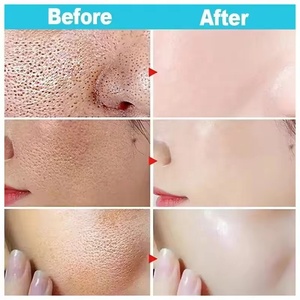 Sérum Facial au Riz Blanc Anti-Pores Dilatés, Éclaircissant et Blanchissant, Anti-Rides et Ridules pour une Peau Lumineuse et Ferme - Product Image 2