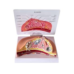 Tıbbi Öğretim İçin Yaygın Patolojileri İçeren İnsan Meme Anatomisi Modeli - Product Image 4