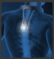 Correcteur de posture intelligent : Dispositif de suivi scientifique en temps réel pour l'entraînement et la correction de la posture dorsale pour adultes