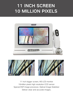 เครื่องสแกนหนังศีรษะแบบพกพา 10 HD ตรวจจับรูขุมขน วิเคราะห์เส้นผมและผิวหนัง 4 สเปกตรัม ขนาด 11 นิ้ว สำหรับร้านเสริมสวยและร้านตัดผม - Product Image 2
