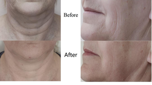 Offre Spéciale BIO microcourant beauté Machine galvanique visage tonifiant gants Type de bureau avec US IT ZA CN bouchons prix usine - Product Image 5