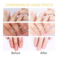 Huile à cuticules bio ZH OEM avec compte-gouttes 10ml, revitalisante et réparatrice, pour salon de manucure, soin des ongles, parfum fruité, pour des ongles plus forts