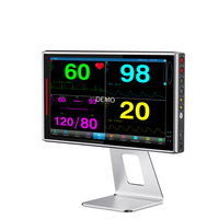 Moniteur patient vétérinaire Derry VK18 pour hôpitaux vétérinaires - Équipement de surveillance des signes vitaux certifié ISO13485 avec garantie d'un an