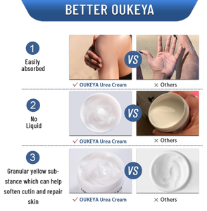 <span class=keywords><strong>Crema</strong></span> de Aminoácidos y <span class=keywords><strong>Urea</strong></span> para el Cuidado de la Piel al por Mayor, Suaviza los Pies, Rodillas, Codos y Manos, Elimina la Piel Muerta, Cutículas y Callos, para Talones Secos y Agrietados - Product Image 5