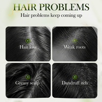 Ekstrak Daun THUJA ORIENTALIS Ekstrak Akar SOPHORA FLAVESCENS Menenangkan Gatal Kulit Kepala Memperkuat Akar Rambut Mengurangi Kerontokan Rambut