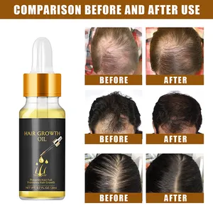 OEM Private Label trattamento per la perdita di cura del cuoio capelluto naturale olio per la crescita dei capelli