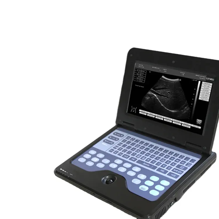 CONTEC CMS600P2 doppler ultrasound equipment medical equipment machine