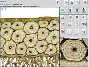 메타시크 양자 분석기 밀리미터파 치료기 자동 분석 프린터 보고서 95% 정확도 5분 테스트 시간 - Product Image 4
