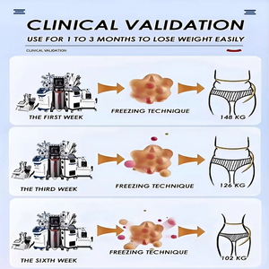 Macchina per Criolipolisi 360° Z Fat Freezing, Apparecchio per Dimagrimento a Freddo, Macchina per Crioliposuzione, Dispositivo per <span class=keywords><strong>Crioterapia</strong></span> e Perdita di Peso - Product Image 3