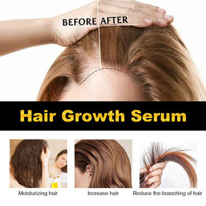 Wholesale 100% Natural Organic African <b>Hair</b> Loss Products 30ml <b>Hair</b> Growth Serum <b>Oil</b> Concentration Private Label <b>Hair</b> Care - Product Image 2