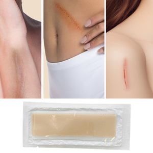 Boîte personnalisée Feuille de gel cicatriciel en silicone de qualité médicale, respirante, pour l'élimination des cicatrices. - Product Image 2