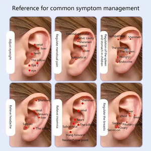 2025 keluaran baru 10 buah/strip stiker tekanan titik akupuntur telinga Tradisional Cina biji telinga dengan pita bening - Product Image 4