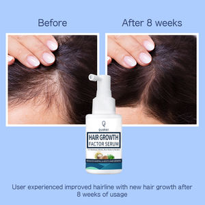 Qquaker Meilleure vente Réparation Follicules 3% Redensyl Croissance Réduire la perte de cheveux <span class=keywords><strong>Spray</strong></span> Sérum capillaire de marque privée - Product Image 2