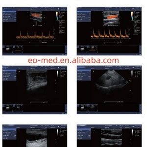 Échographe Doppler Couleur Portable de Qualité Supérieure Chine - Système d'Échographie Portable CU23 - Product Image 6