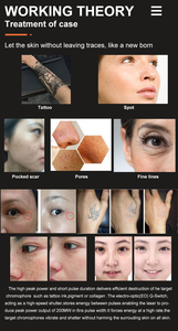 Pico <span class=keywords><strong>Laser</strong></span> Picosecond Nd Yag Chuyển Mạch Q Xóa Hình Xăm Trẻ Hóa Da - Product Image 6