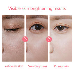 Set Siero Schiarente OEM con 10% Niacinamide Illumina la Pelle Spenta Riduce le Macchie Scure e Migliora il Tono Irregolare per una Carnagione Più Liscia - Product Image 3