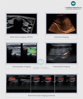 C60 perangkat Ultrasound medis elasografi 5D 4D kelas tinggi USG untuk MSK cardologi perut warna Doppler instrumen Ultrasound