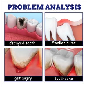 Fórmula profesional Ecológico Alivio del dolor de muelas Spray <span class=keywords><strong>Ingredientes</strong></span> herbales naturales para un control temporal efectivo del dolor 20ml - Product Image 5