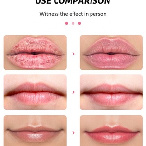 Crema de Sal del Himalaya para el Cuidado de Labios de Marca Privada de 30 g, Exfoliante, Hidratante, Suavizante, Iluminadora de Labios Oscuros, Reduce las Líneas de los Labios - Product Image 6