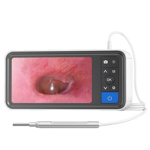 Otoscope haute définition Medco Ms450 avec écran, outil de nettoyage d'oreilles, caméra 2.0MP, couleur grise, fonction de nettoyage - Product Image 3