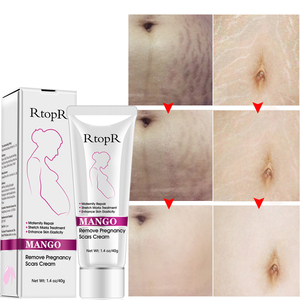 Crème à la Mangue pour Vergetures de Grossesse, Répare les Cicatrices et les Vergetures Abdominales - Product Image 4