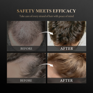 Biểu Tượng Tùy Chỉnh Không Độc Hại Hiệu Quả Tăng Trưởng Tóc Kích thích Chống Rụng Tóc Hữu Cơ Tăng Trưởng Tóc Dầu Gội Đầu - Product Image 4
