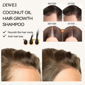 Set de Cuidado Capilar de Marca Privada DIWEI, Sin Sulfatos, Aceite de Coco, Orgánico, Antiencrespamiento, Champú y Acondicionador para Cabello Rizado Dañado - Product Image 2
