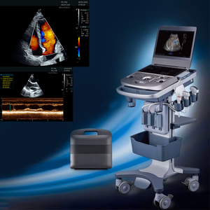Échographe vétérinaire portable sans fil avec sondes convexe et linéaire pour la détection de la grossesse - Product Image 5