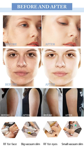 Vela vide rouleau minceur 5 en 1 rapide efficace perte de poids corps sculpteur boule intérieure rouleau Velas <span class=keywords><strong>hape</strong></span> graisse perte Machine - Product Image 2