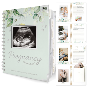 Libro de Recuerdos de Embarazo Personalizado al por Mayor, Encuadernado en Espiral, Tapa Dura, Libro de Recuerdos <span class=keywords><strong>para</strong></span> Bebés, Álbum de Fotos de Ultrasonido, Regalo <span class=keywords><strong>para</strong></span> Mamás - Product Image 1