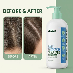 Champú de Ácido Láctico 12% AHA Exfoliante 2 en 1 para Limpieza Profunda y Cuidado del Cuero Cabelludo, Clarificante para Cuero Cabelludo Graso, Escamoso y con Picazón, Limpia y Desincrusta - Product Image 6